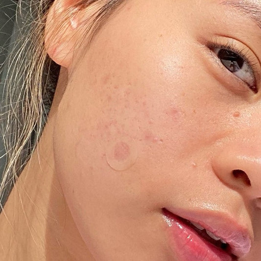 Zit Object The Spot – Page 8 – ZitSticka UK