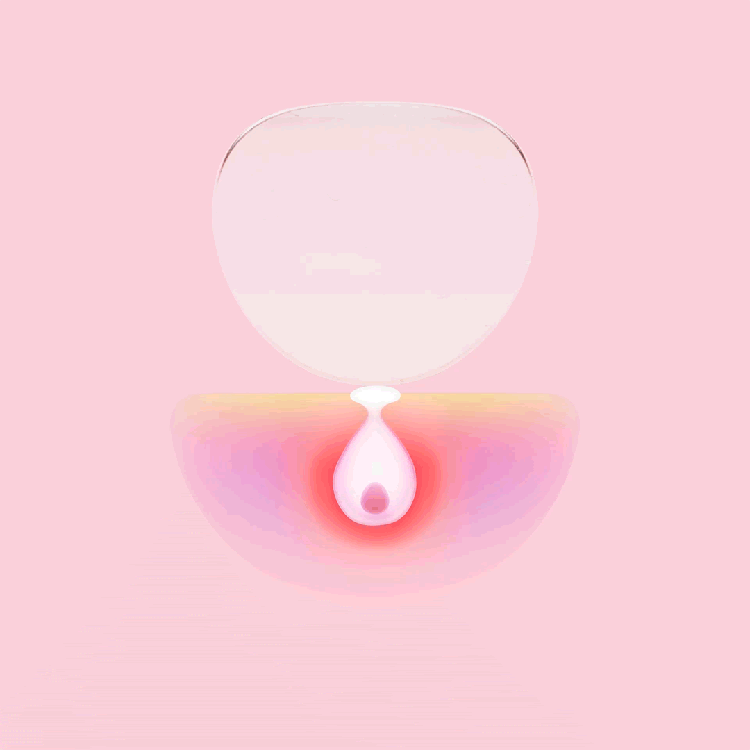 What's the difference between a hydrocolloid and microdart patch? –  ZitSticka UK