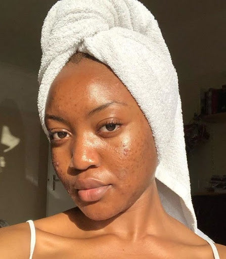 How to block dark spots, acne & look dewy—all at once